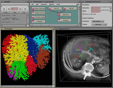 Image result for MeVisLab Features
