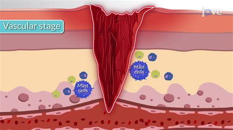 Video: Inflammatory Response I: Vascular and Cellular