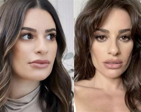 Buccal fat removal: Lea Michele selfie starts rumours about cosmetic facial procedure that is ...