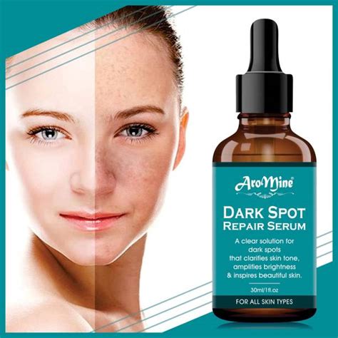 Dark Spot Remover Cream - Buy Dark Spot Remover Cream online at Best ...