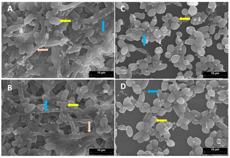 Effect of Quorum Sensing Molecule Farnesol on Mixed Biofilms of Candida ...