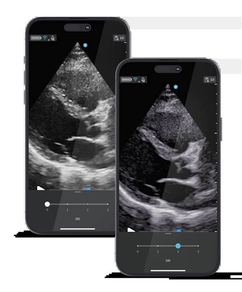 Wireless handheld cardiac & vascular ultrasound | Vscan Air™ SL