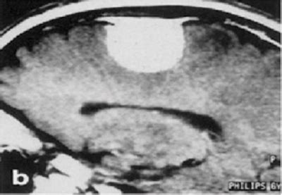 Contrast Media - Gadoniray