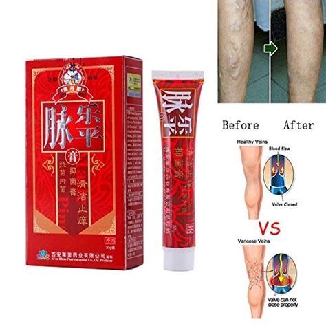 Buy Varicose Veins Cream 30g, Blood Vessel Care Venous Ointment Improve ...