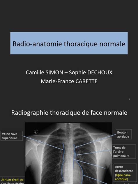 Image result for Poumon Normal Scanner