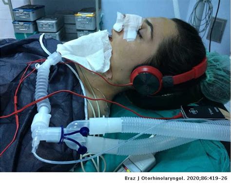 Anesthesia Record Example 的图像结果