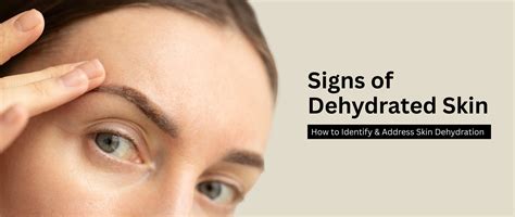 Dehydrated Skin Signs & Solutions | Identify & Fix Skin Dehydration ...