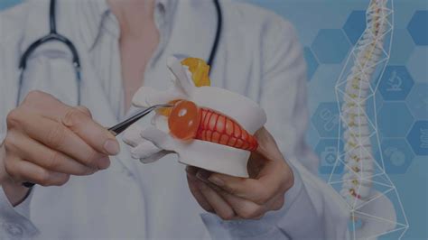 How to Heal a Herniated Disc Quickly: Tips to Fix Herniated Disc