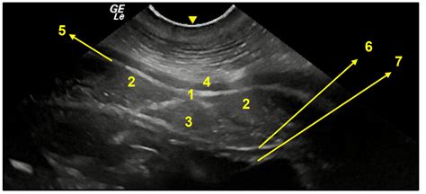Surgical Anatomy for Sterilization Procedures in Female Capybaras