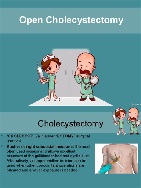 Open Cholecystectomy 的图像结果