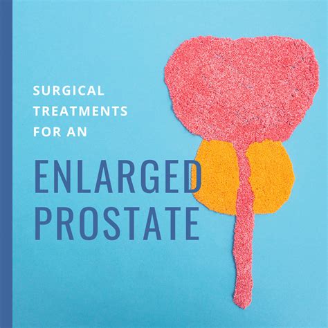 Surgical Treatments for an Enlarged Prostate | New York City | 1 Prostate Center