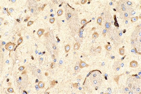 MIA3 antibody (17481-1-AP) | Proteintech