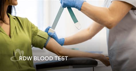 RDW Blood Test: Purpose, Procedure and Result Interpretation | Thomson Medical