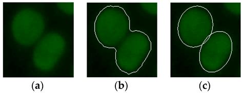 An Automatic HEp-2 Specimen Analysis System Based on an Active Contours ...