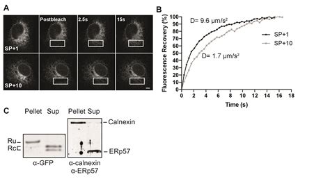 Image result for Aronson Stack Order
