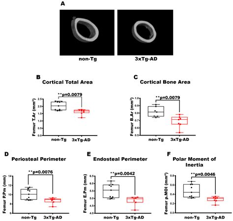 Cortical Bone Loss and Fragility in a 2-Month Triple Transgenic Mouse ...