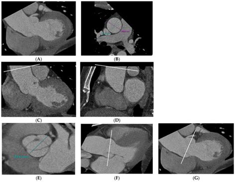 JCDD | Special Issue : Current Practice in Cardiac Imaging