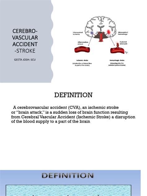 Image result for CVA Recovery