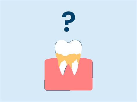 Image result for Bottom Teeth Calcium Buildup