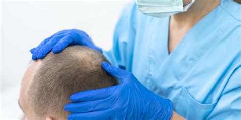 Recovery & Hair Growth Timeline After Hair Transplant