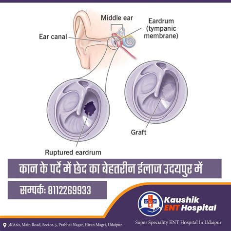 Understanding Ear Pain in Children: Symptoms, Causes, and Treatment Options - Kaushik ENT Hospital