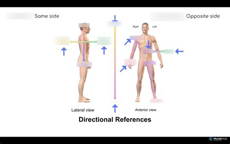 Image result for Contralateral Anatomical Position