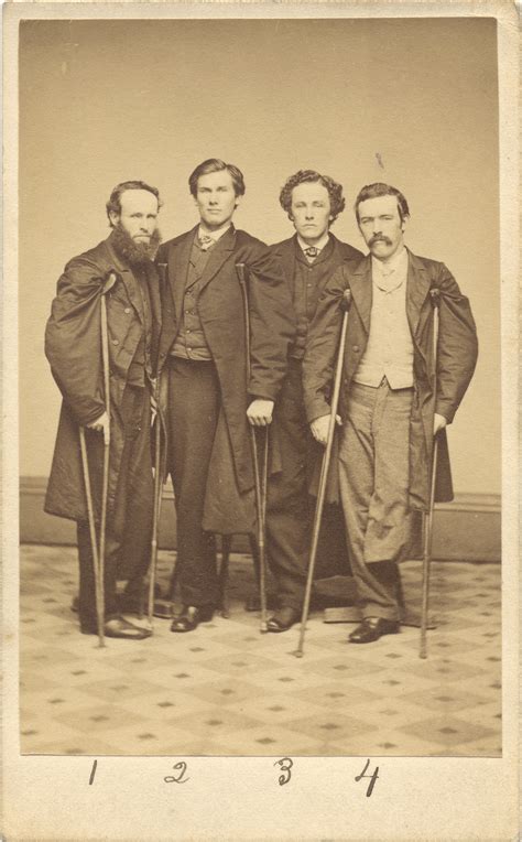 Civil War Amputations