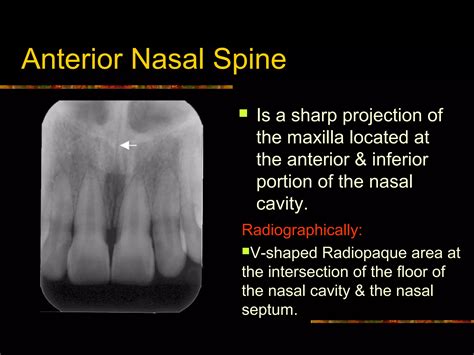 Intra Oral radiographic anatomical landmarks | PPT