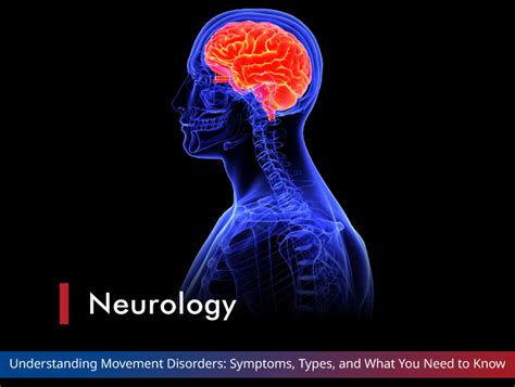 Paralysis 的图像结果