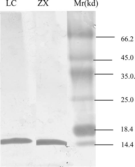 Characteristics of Lipo-Oligosaccharide Loci of Campylobacter jejuni ...