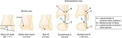 Ankle and Foot Injuries - Clinical Tree