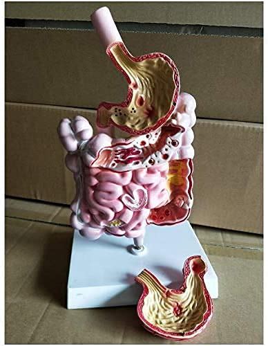 Buy CXQA Human Organ Anatomical Model, Digestive System Disease Model ...