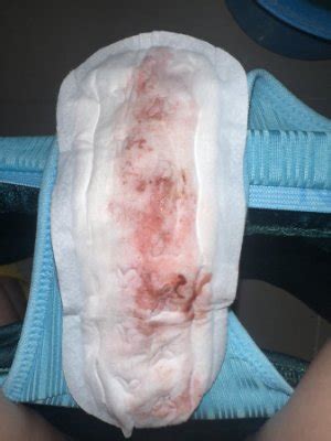 Implantation or Bleeding? Pls help ASAP | BabyCenter