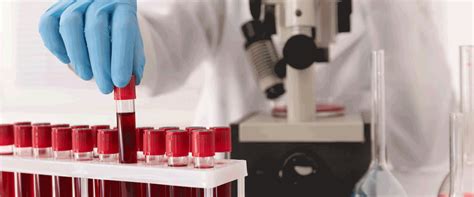Regular Blood Donation May Influence Genetic Changes Linked to Lower ...