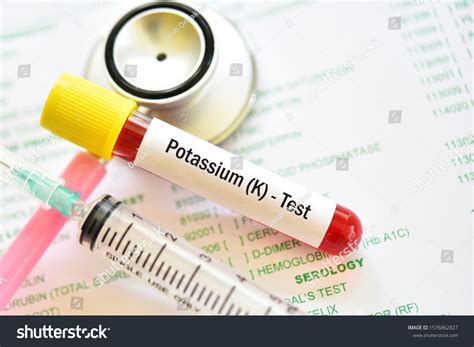 5+ Hundred Potassium Blood Test Royalty-Free Images, Stock Photos ...