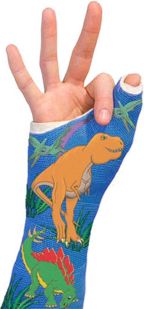 Image result for Custom Cast Design