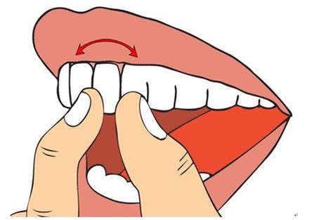 牙龈出血、牙齿变长、松动，牙周病不治疗会自行好转吗?-海南口腔医院【官网】