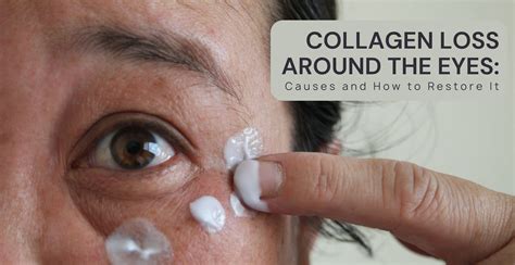 Collagen Loss Around the Eyes: Causes and How to Restore | Clinikally