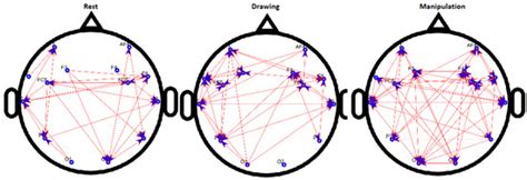 Connectivity Analysis Using Functional Brain Networks to Evaluate ...