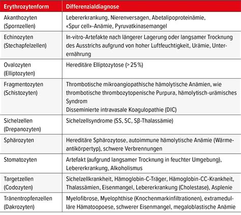 Interpretation des mikroskopischen Blutbildes - Allgemeine Innere ...