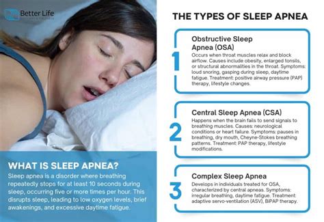 Image result for Sleep Apnea Example