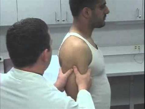 Image result for Sulcus Sign Grading