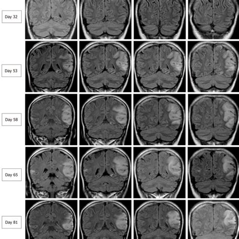 Serial Brain 2 的图像结果
