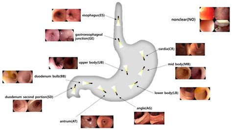 Deep Learning Models for Anatomical Location Classification in Esophagogastroduodenoscopy Images ...