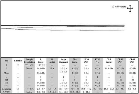 Frontiers | Case report: Chronic disseminated intravascular coagulopathy with concurrent ...