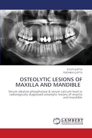 Buy Osteolytic Lesions of Maxilla and Mandible Book Online at Low ...