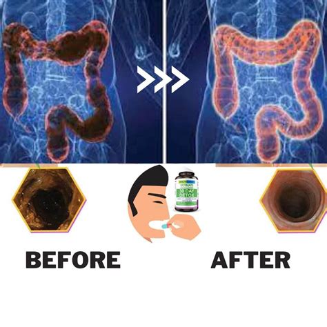 Colon Cleanse Before And After Colon Detox : Target