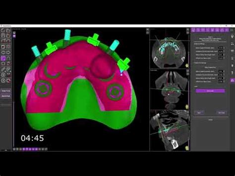 Image result for Stackable Guide Dailymotion