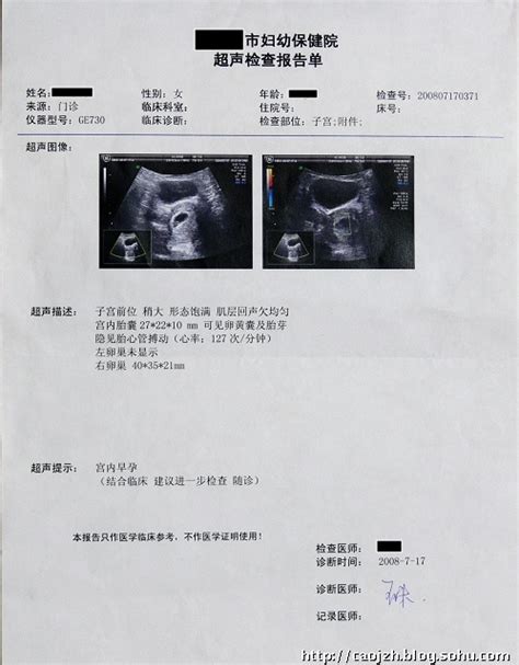 怀孕6周多B超显示孕囊2.1*1.3*3.1cm，内见胚芽0.7cm是什么意思啊？还有血清的报告单怎么看呀？_360问答