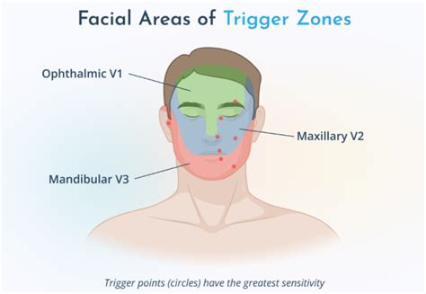 Common Symptoms of Trigeminal Neuralgia Patients Should Not Ignore
